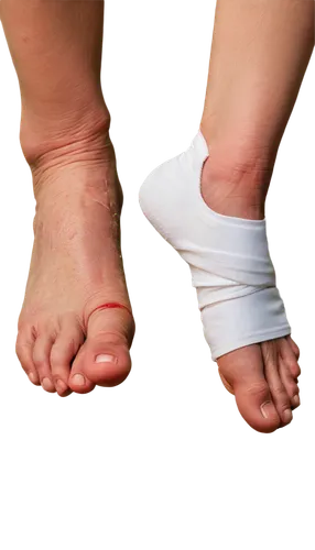 Foot ulcer, close-up, detailed skin texture, redness around wound, pus or blood visible, swollen toe, bandaged foot, worn-out shoes, dirty socks, medical lighting, 3/4 composition, shallow depth of fi