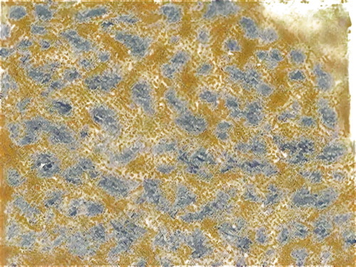 brown mold,abstract gold embossed,puccinia,propolis,cytokeratin,springtail,amphibole,springtails,xanthomonas,yellow wallpaper,trichoderma,cyanobacterium,biofilm,bioturbation,koli bacteria,dermatophytes,actinobacteria,teliospores,biofilms,pollen,Photography,Documentary Photography,Documentary Photography 29