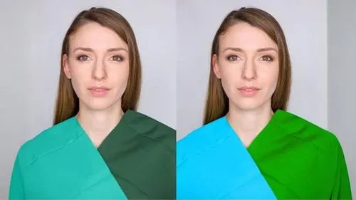 depigmentation,stereograms,rhinoplasty,greenscreen,stereogram,denoising