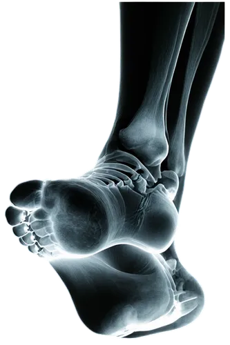 reflex foot sigmoid,podiatrists,reflex foot kidney,foot reflex zones,podiatrist,orthotics,podiatric,orthotic,neuroma,podiatry,calcaneus,polyneuropathy,metatarsal,foot reflex,foot reflexology,forefoot,navicular,fibular,hindfoot,dorsiflexion,Photography,Artistic Photography,Artistic Photography 09