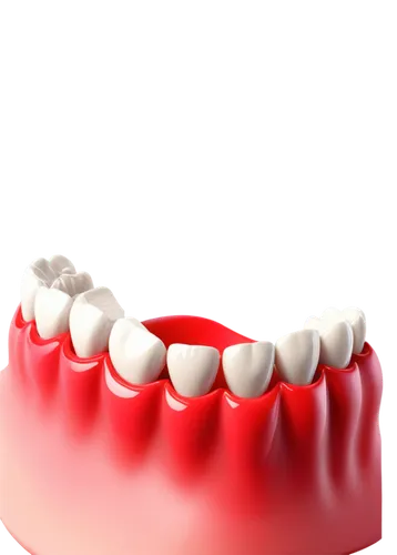 Dental implant, infected gum, red swollen tissue, pus around implant, broken abutment, titanium surface, 3D model, X-ray composition, high contrast lighting, close-up shot, macro photography, realisti