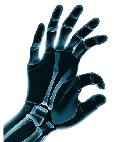 metacarpal,skeleton hand,metacarpals,hand prosthesis,handshake icon,hand digital painting,scaphoid,bionics,hand detector,human hand,carpal,interphalangeal,sesamoid,handshape,handleman,touch screen hand,synovitis,arthritis,phalanges,syndactyly,Conceptual Art,Oil color,Oil Color 04