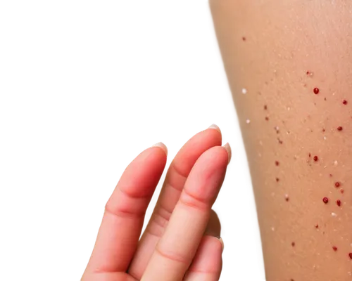 keratosis,pityriasis,scuticaria,epidermal,dermatologic,petechiae,psoriasis,epidermolysis,melanomas,folliculitis,papules,dermatitis,dermatosis,leishmaniasis,keratoses,eczema,hyperkeratosis,epidermis,pemphigoid,dermatomyositis,Art,Classical Oil Painting,Classical Oil Painting 13