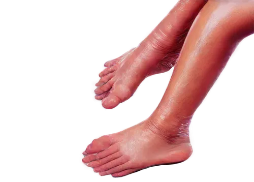 foot model,lymphedema,foot reflexology,keratoderma,foot reflex,venules,reflexology,foot reflex zones,foot,hindfeet,thrombophlebitis,polyneuropathy,feet,neuroma,calamine,oedema,feet closeup,membranacea,valgus,podiatry,Illustration,Realistic Fantasy,Realistic Fantasy 28