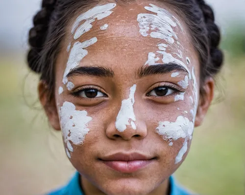 Girl with vitiligo by Mikhail Shestakov (Russian Federation) – 1st Place Winner – People Discovery of the Year 2016,ethiopian girl,face paint,clay mask,peruvian women,portrait of a girl,indian girl,na