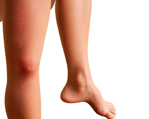 sclerotherapy,cellulitis,thrombophlebitis,erythema,lymphedema,keratosis,melanomas,prolotherapy,phlebitis,pityriasis,epidermis,woman's legs,dermatomyositis,patellar,polyarthritis,abrasions,keratoses,osteoarthritis,women's legs,rodilla,Art,Classical Oil Painting,Classical Oil Painting 15