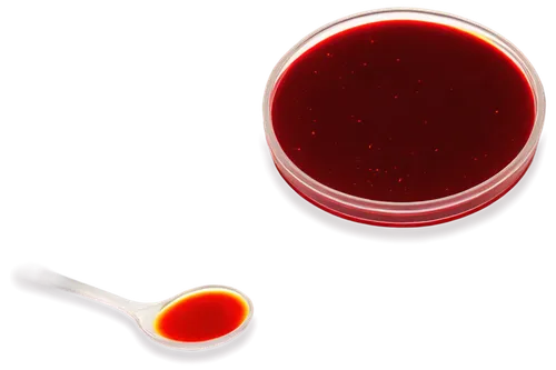 Microscopic view, blood clots, urine sample, transparent Petri dish, yellowish liquid background, irregularly shaped clots, dark red color, blurry edges, soft focus, warm lighting, 3/4 composition.,er