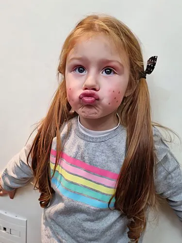 hemangiomas,lilyana,gingerbread girl,choksi,diabetes with toddler,adrenoleukodystrophy,cake smash,tinymud,lilladher,tiramisu,chocoholic,kleine,hypotonia,pequena,simonetta,kiskeya,nutella,madeleine,chocolate,toddler