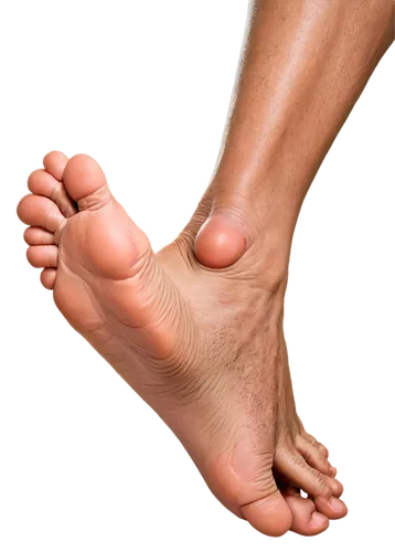 Diabetic foot, senior male, worn-out shoes, socks with holes, varicose veins, redness, swelling, bruises, dry skin, cracked heels, fungal infection, toenail fungus, gangrene, amputation risk, close-up