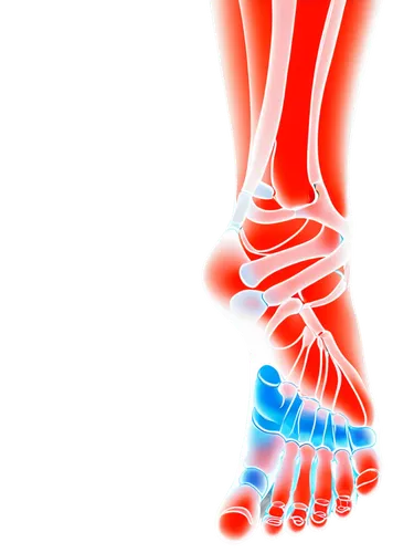 X-ray image, foot anatomy, heel bone spur, inflamed tissue, calcification, bony outgrowth, plantar fascia, Achilles tendon, medical illustration, detailed texture, high contrast, dark background, 3/4 