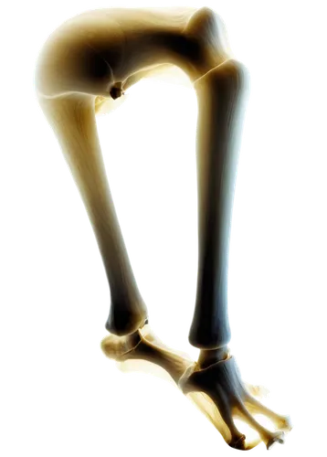 osteoarthritis,leg bone,dorsiflexion,artificial joint,fibular,osteoporotic,prosthesis,sesamoid,woman's legs,orthopedics,biomechanically,tibia,foot reflex,soleus,hindfeet,leg,foot model,naharin,u leg bridge,sciatica,Art,Artistic Painting,Artistic Painting 47