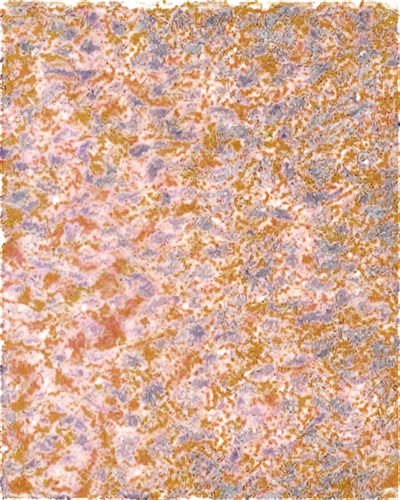 kngwarreye,epidermis,megamendung batik pattern,sebatik,epidermidis,epidermal,brown mold,batik,cytokeratin,immunohistochemical,terrazzo,marpat,hepatocytes,napaltjarri,leopardskin,hyperkeratosis,pemphigoid,biofilms,porphyry,pneumococci,Art,Artistic Painting,Artistic Painting 47