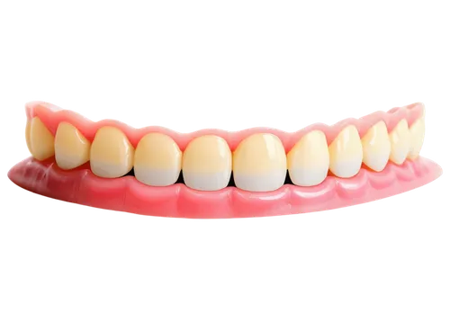 Caries teeth, dental problem, close-up, mouth open, yellowish teeth, cavities, plaque buildup, gum recession, crooked teeth, metal filling, X-ray effect, high contrast, dramatic lighting, shallow dept