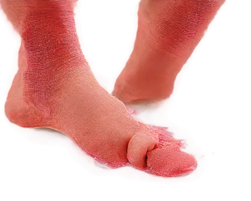 foot model,toe,neuroma,foot,lymphedema,polyneuropathy,the foot,reflex foot kidney,foot reflexology,reflex foot esophagus,reflex foot sigmoid,metatarsal,foot reflex,hindfeet,neuropathy,footsore,hindfoot,podiatry,onychomycosis,edema,Conceptual Art,Fantasy,Fantasy 14