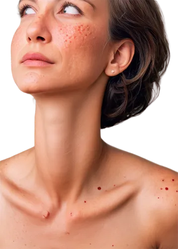 rosacea,keratosis,folliculitis,epidermal,dermatologic,microdermabrasion,cutaneous,membranacea,epidermis,pityriasis,skin texture,melanomas,scuticaria,dermatitis,dermagraft,dermatosis,hyperpigmentation,hypothyroidism,keratoses,epidermolysis,Conceptual Art,Sci-Fi,Sci-Fi 16