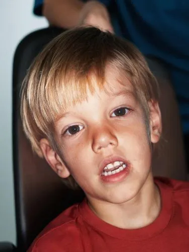 A young boy, about 6 and a 1/2 years old with a misalignment of his eyes. He is sitting in an eye doctor's chair, tilting his head towards his right shoulder. The child is concerned about this and has