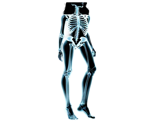 skeletal,skeletal structure,human skeleton,osteoporotic,skeleton,radiograph,osteoporosis,osteopenia,osteopath,halloween vector character,radiography,osteopathy,osteomalacia,the human body,human body,radiographer,uv,xray,radiographs,radiologic,Illustration,Black and White,Black and White 31