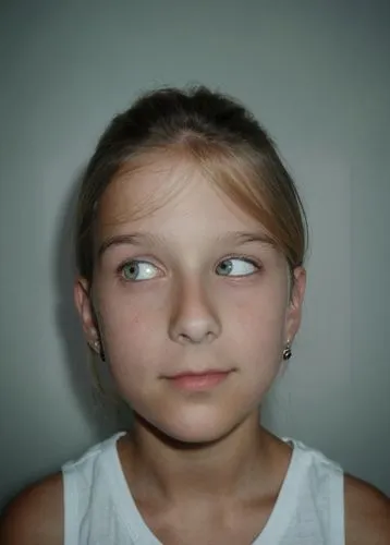 amblyopia,strabismus,the girl's face,children's eyes,girl on a white background,anosognosia,anosmia,mutism,nystagmus,adrenoleukodystrophy,trichotillomania,worried girl,apraxia,girl in t-shirt,girl with speech bubble,kimberlee,psychophysiological,prosopagnosia,hypotonia,mononucleosis