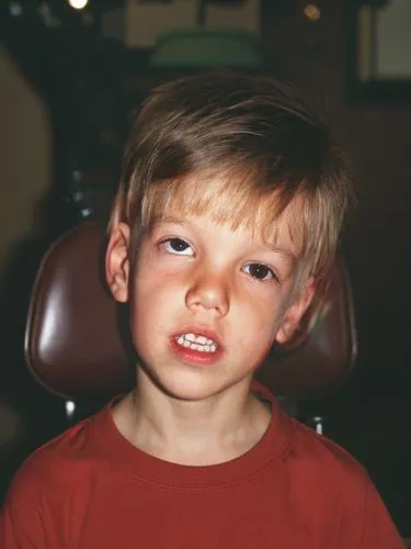 retinoblastoma,adrenoleukodystrophy,littrell,macaulay,leukodystrophy,sprouse,depigmentation,ttd,jaxon,bergling,hypotonia,hypopigmentation,fetus,max verstappen,macauley,kodachrome,culkin,strabismus,angioedema,cobain