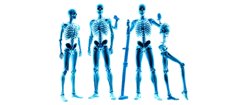 osteoporotic,skeletons,skeletal,osteopathy,osteopath,osteopaths,osteoporosis,osteopathic,orthopedics,cryonics,radiographs,musculoskeletal,human skeleton,femurs,radiologic,skeletal structure,orthopedists,chiroscience,osteoarthritis,osteomalacia,Illustration,Realistic Fantasy,Realistic Fantasy 25