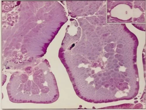 Take a high-resolution histological image demonstrating vincristine-induced axonal and neuronal degeneration in the spinal cord of old rats. Histological imaging should demonstrate spherical vacuoles 