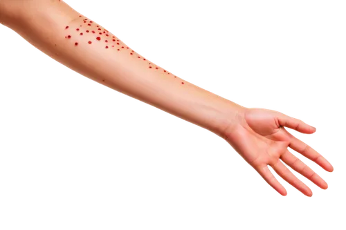 dermatomyositis,keratosis,epidermal,psoriasis,epidermolysis,mesodermal,melanomas,dermatosis,pityriasis,scuticaria,papules,keratoderma,dermatologic,mesostigmata,epidermis,cutaneous,folliculitis,hyperkeratosis,polyarthritis,membranacea,Illustration,Paper based,Paper Based 07