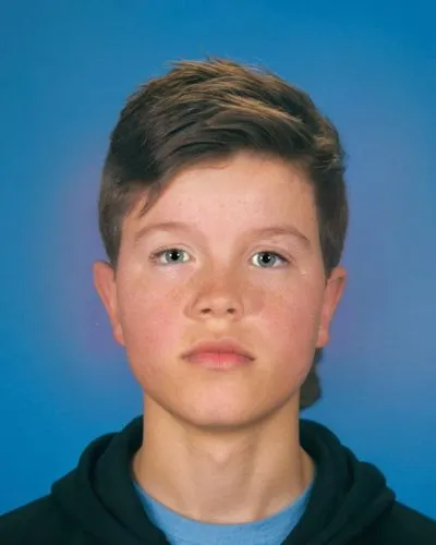 A 15-year-old boy with a Left Brown's syndrome. He is looking directly at the camera. He has a very slight elevation of his chin. He has a neutral look on his face. The Boy is the only person in the p