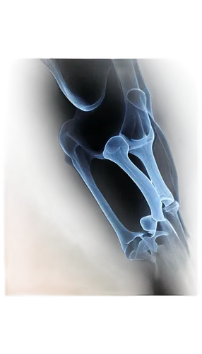 osteoporotic,osteoarthritis,ligamentum,radiograph,osteomyelitis,orthopedics,thighbone,navicular,glenoid,osteomalacia,x-ray of the jaw,metacarpal,sesamoid,tuberosity,artificial joint,tubercle,osteocalcin,ligamentous,radiographs,osteopenia,Illustration,Japanese style,Japanese Style 21