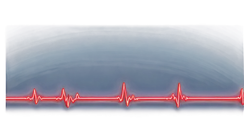 cardiogram,life stage icon,atrioventricular,electrocardiogram,cardiology,arrhythmia,tavr,heartbeat,heart background,ekg,cardiowest,paraventricular,supraventricular,atrial,repolarization,puls,heart beat,heart rate,arrhythmias,ventricular,Art,Artistic Painting,Artistic Painting 06