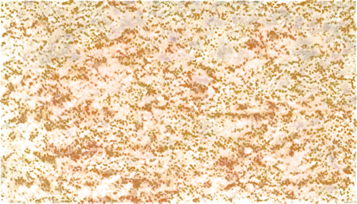 brown mold,biofilms,seamless texture,neurospora,epidermis,biofilm,xanthomonas,puccinia,mycosis,coagulate,immunohistochemical,biofouling,xanthophylls,yeasts,hyperkeratosis,thallus,oxidation,sargassum,epidermidis,angioma,Conceptual Art,Sci-Fi,Sci-Fi 01