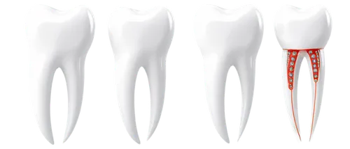 Tooth, dental care, solo, white enamel, sharp tip, root canal, gum line, metal filling, orthodontic wire, close-up, macro shot, shallow depth of field, softbox lighting, detailed texture, realistic re