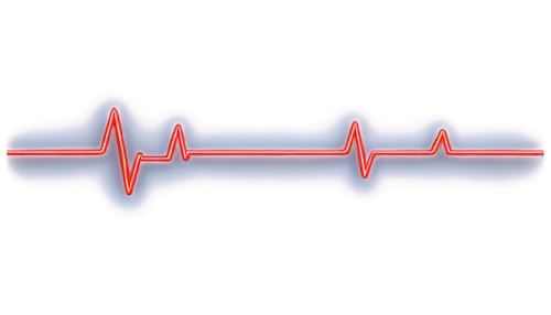 electrocardiogram,electrocardiography,electrocardiograms,cardiogram,electrocardiograph,arrhythmia,antiarrhythmic,atrioventricular,arrhythmias,paraventricular,puls,ekg,asystole,repolarization,cardiological,heart beat,cardiowest,ekgs,heart rate,bradycardia,Illustration,Black and White,Black and White 35