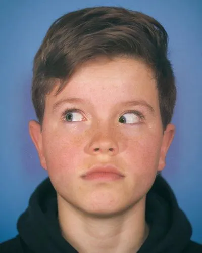 A 15-year-old boy with a left Brown’s syndrome. He is being photographed as part of a routine eye exam and is photographed in front of a plain blue background. He is trying to look directly towards hi