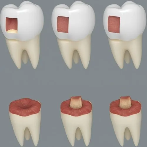 simple and minimalist  3D rendering of tooth. top row shows the root only.,dental icons,cementation,resorption,periodontitis,periodontal,prosthodontics,periapical,periodontist,periodontics,premolars,d