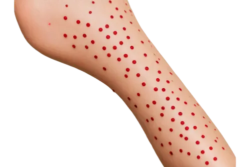 polka dot pattern,red-hot polka,spots,trypophobia,dots,dotted,red hot polka,coral-spot,polka dot,shingles,polka dots,inflammation,dot pattern,heloderma,dermatology,paint spots,dot,corpuscle,venereal diseases,deep tissue,Photography,Documentary Photography,Documentary Photography 11