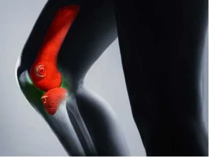 brown back-toucan,keel-billed toucan,keel billed toucan,fighting fish,knee,prostate cancer,femur,saddle-billed stork,toco toucan,perched toucan,artificial joint,chestnut-billed toucan,tail light,yello