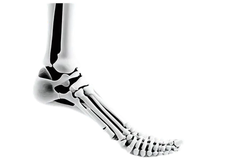 Ankle bones, X-ray image, detailed skeletal structure, white bones on black background, high contrast, 3D-like composition, dramatic lighting, realistic texture, medical illustration style, close-up s