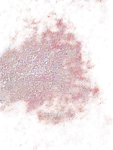 hyperkeratosis,keratosis,coccidioidomycosis,papules,neurospora,sporangium,psittacosis,eosinophilia,angioma,epidermal,pemphigoid,lymphadenopathy,telangiectasia,seminoma,epithelial,trichoderma,intraepithelial,xanthomonas,mycosis,autoradiography,Illustration,Realistic Fantasy,Realistic Fantasy 39