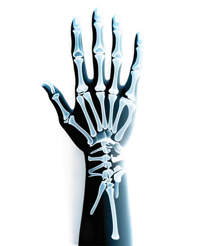 X-ray image, hand fracture, broken bone, sharp edges, white bone fragments, dark background, high contrast, detailed texture, 3/4 composition, shallow depth of field, medical theme, realistic lighting