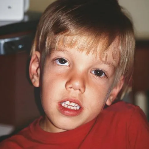 A young boy, about 6 and a 1/2 years old with a misalignment of his eyes. He is sitting in an eye doctor's chair, tilting his head towards his left shoulder, and his right eye abnormally drifts upward