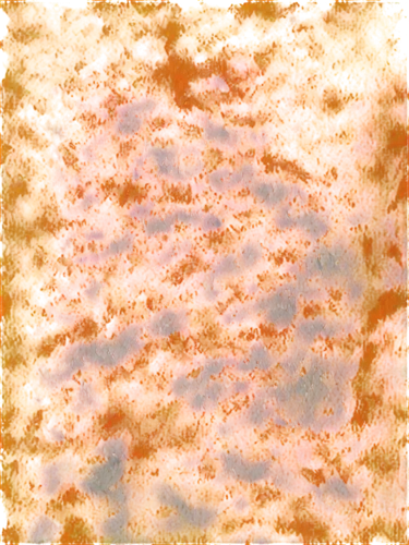 epidermis,koli bacteria,lava,enterococci,pediculosis,mesostigmata,biofilm,epidermidis,lava river,trichoderma,pintada,morgellons,epidermal,monolayer,bitumen,staphylococci,cyano,pavement,pneumococci,merozoites,Conceptual Art,Daily,Daily 32