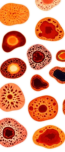 Necrotic tissue, microscopic view, cellular death, dark brownish discoloration, irregular shapes, fragmented nuclei, swollen cells, lysed cell membranes, pyknotic nuclei, eosinophilic cytoplasm, hemor