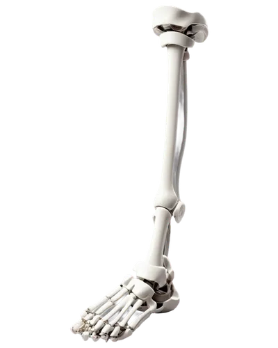 X-ray image, fibula fracture, broken bone, medical illustration, detailed anatomy, white background, 3D composition, high-contrast lighting, realistic texture, isolated object, solo focus, cinematic r